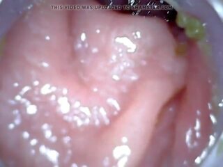 Anale endoscope parte 1, gratis clistere punizione hd x nominale clip 04